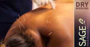 Dry Needling