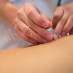 Schedule your acupuncture session